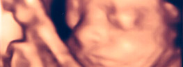 3d ultrasound photo
